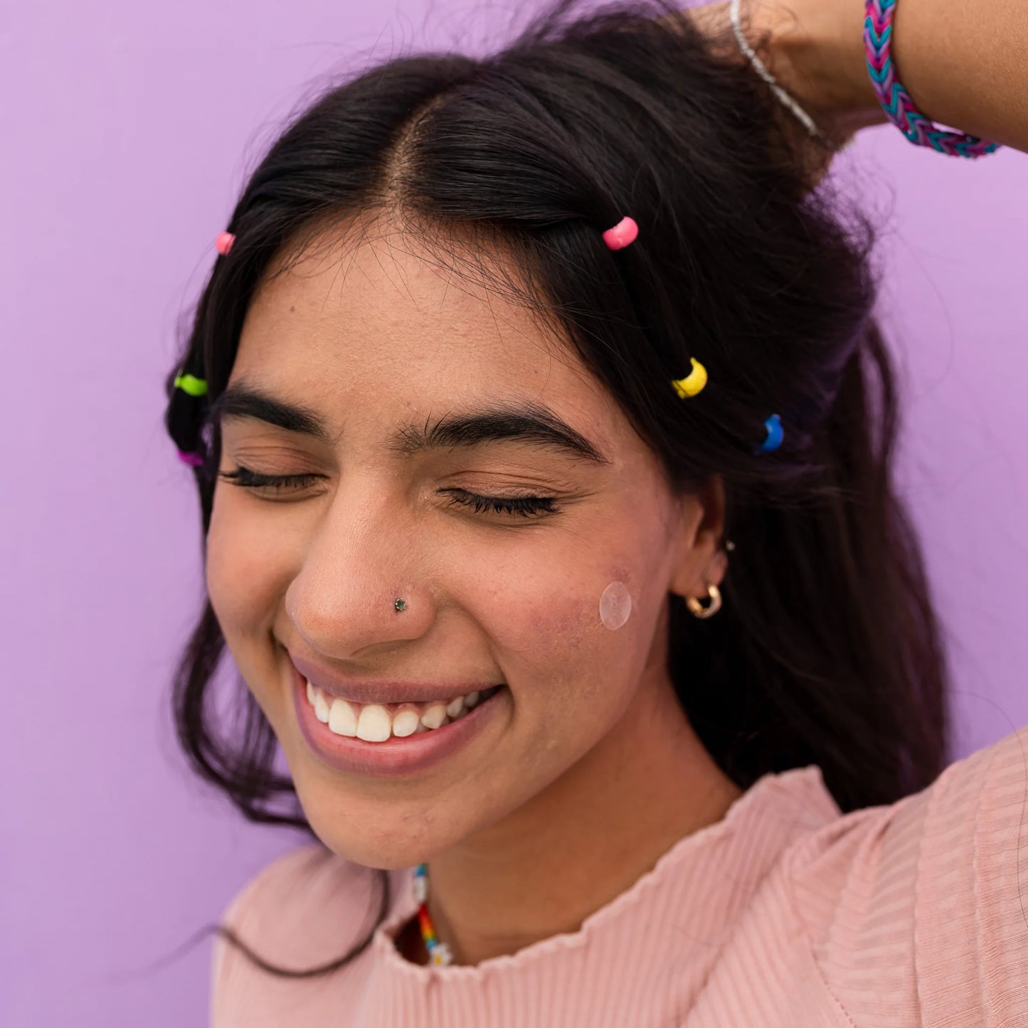 Acne Healing Dots